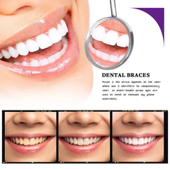 Bright white smile with dental braces transformation, before and after teeth whitening results