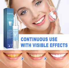 Gum Protect repair gel for brighter teeth, continuous use with visible whitening results