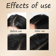 Before and after hair thickening results showing fuller scalp coverage