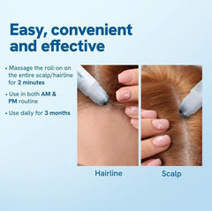 Roll-on scalp and hairline treatment for daily hair care routine