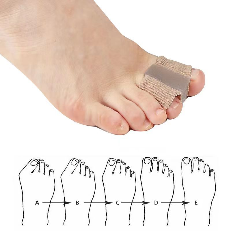Toe separator for foot comfort, shown on big toe with alignment diagram