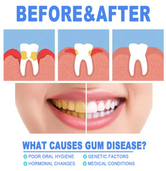 Before and after gum disease treatment showing healthy vs. inflamed gums and teeth whitening results